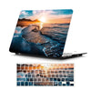 Suitable For MacBook , Customizable Painted Hard Shell